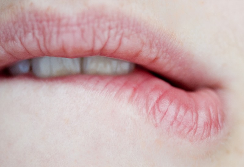 Что губы могут сказать о здоровье человека