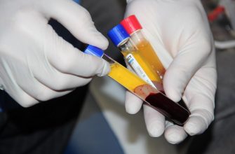 "Золотая кровь": Какая группа крови является самой дорогой в мире