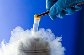 Криоконсервация спермы: современные возможности репродуктивной медицины