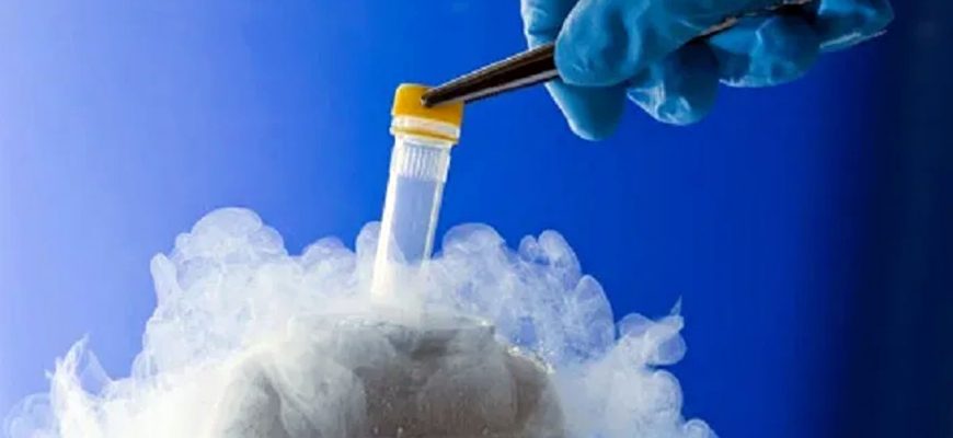 Криоконсервация спермы: современные возможности репродуктивной медицины